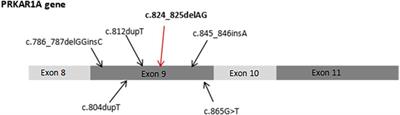 Genetic and clinical phenotypic analysis of carney complex with external auditory canal myxoma